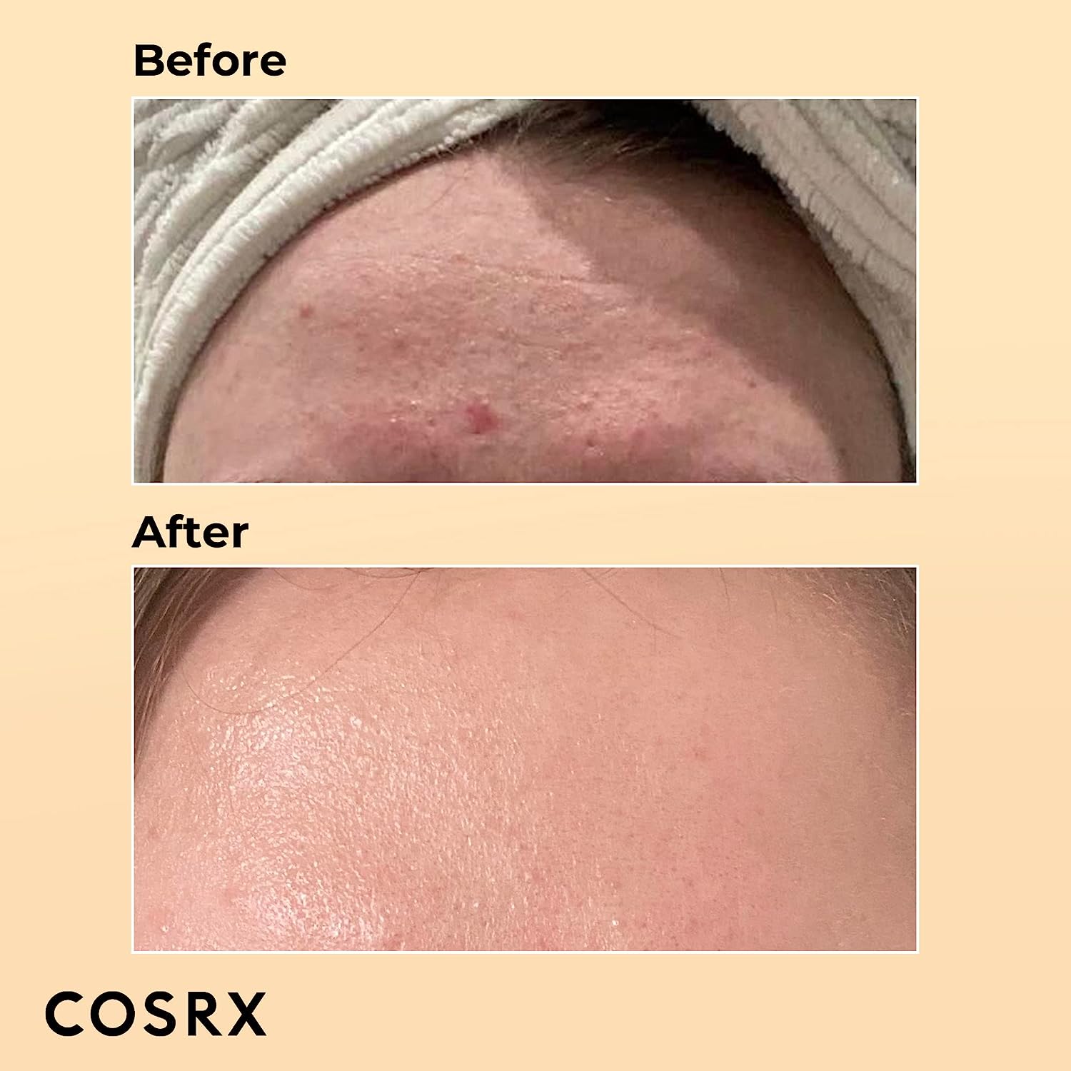 cos2.jpg COSRX Snail Mucin 96% Power Repairing Essence100ml, Hydrating Serum - Image 2