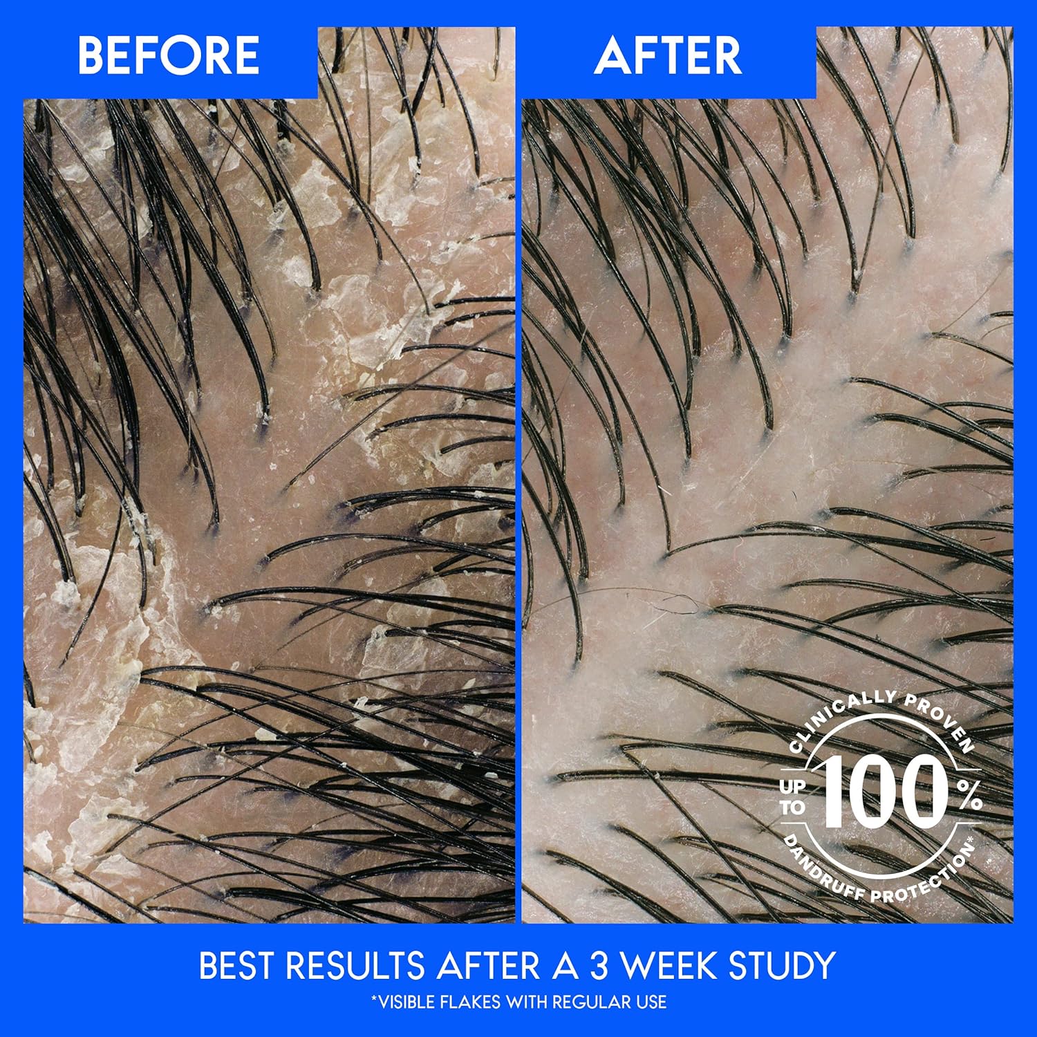 headd2.jpg Head and Shoulders Shampoo and Conditioner 2 in 1, Anti Dandruff Treatment - Image 2