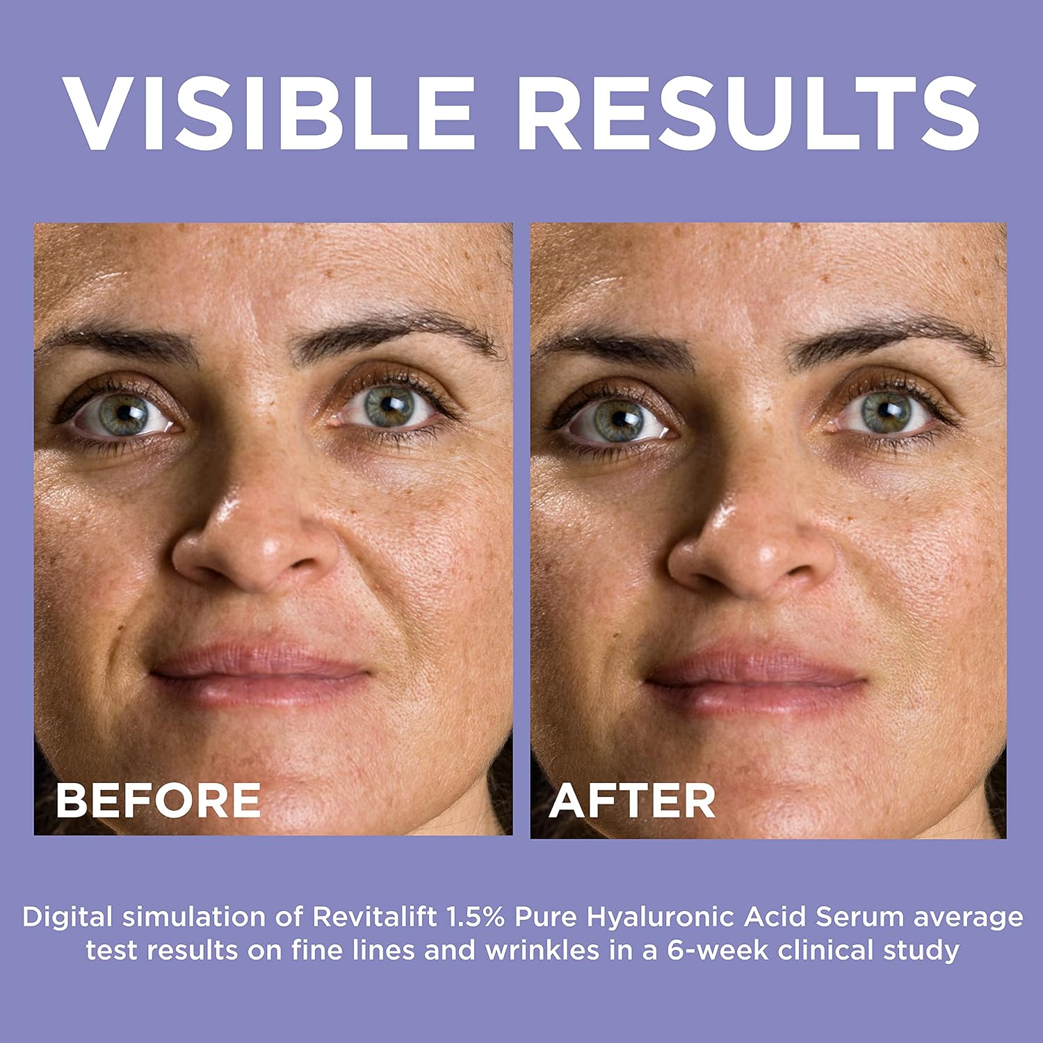 lo2.jpg L’Oréal Paris Revitalift 1.5% Pure Hyaluronic Acid Face Serum - Image 2